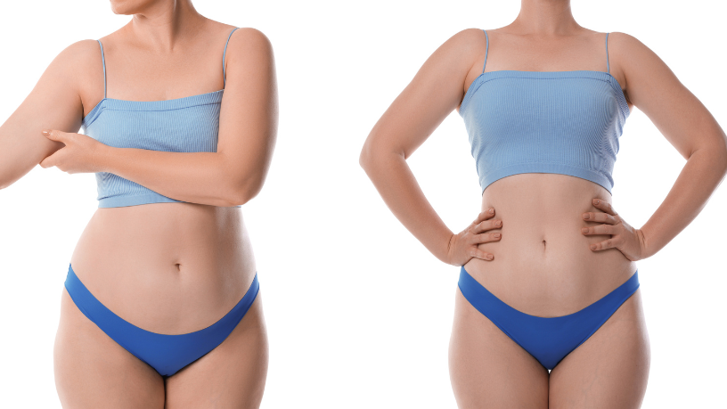 Mudança imediata nem sempre é regra: o prazo real dos resultados varia conforme o procedimento, lembra Milton Seigi Hayashi.